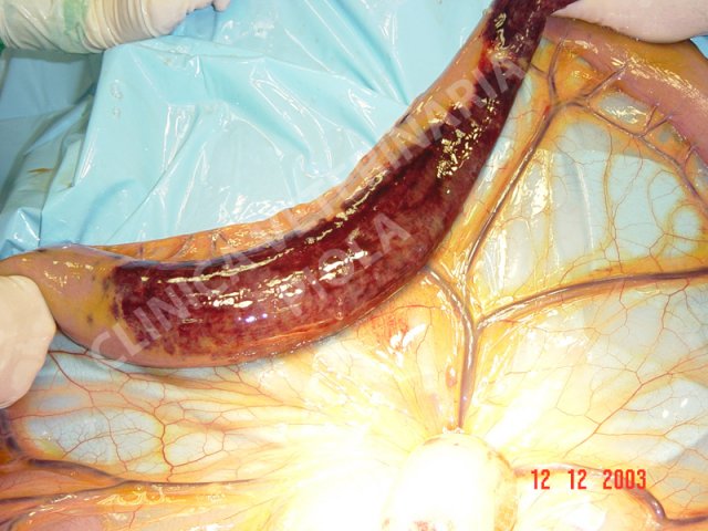Infarto 2